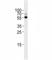 Transforming growth factor beta-2 antibody, F44149-0.4ML, NSJ Bioreagents, Immunohistochemistry paraffin image 