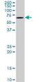 RAC-gamma serine/threonine-protein kinase antibody, H00010000-M03, Novus Biologicals, Western Blot image 