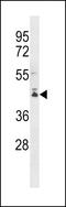 Protein-L-Isoaspartate (D-Aspartate) O-Methyltransferase Domain Containing 2 antibody, LS-C158555, Lifespan Biosciences, Western Blot image 