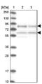 Transcription Factor 25 antibody, PA5-59729, Invitrogen Antibodies, Western Blot image 