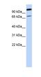 Solute Carrier Organic Anion Transporter Family Member 1B7 (Putative) antibody, orb325171, Biorbyt, Western Blot image 