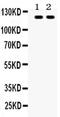 Toll Like Receptor 8 antibody, PA5-80136, Invitrogen Antibodies, Western Blot image 