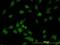 Interleukin 1 Receptor Associated Kinase 1 antibody, orb89629, Biorbyt, Immunocytochemistry image 