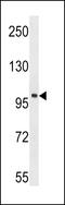 Activated CDC42 kinase 1 antibody, LS-C99164, Lifespan Biosciences, Western Blot image 