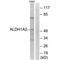 Aldehyde Dehydrogenase 1 Family Member A2 antibody, PA5-50112, Invitrogen Antibodies, Western Blot image 