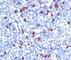 Ig kappa-b4 chain C region antibody, V7032IHC-7ML, NSJ Bioreagents, Immunohistochemistry paraffin image 