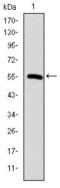 Chaperonin Containing TCP1 Subunit 2 antibody, GTX60505, GeneTex, Western Blot image 