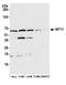 Integrator complex subunit 11 antibody, A301-274A, Bethyl Labs, Western Blot image 