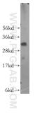 NmrA Like Redox Sensor 1 antibody, 15765-1-AP, Proteintech Group, Western Blot image 