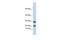 Lipocalin 8 antibody, GTX44849, GeneTex, Western Blot image 