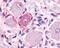 MAS Related GPR Family Member E antibody, NLS4343, Novus Biologicals, Immunohistochemistry paraffin image 