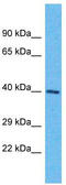 Olfactory Receptor Family 6 Subfamily K Member 6 antibody, TA337537, Origene, Western Blot image 