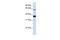 Sphingomyelin Phosphodiesterase 3 antibody, GTX46086, GeneTex, Western Blot image 