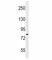 Component Of Inhibitor Of Nuclear Factor Kappa B Kinase Complex antibody, F47192-0.4ML, NSJ Bioreagents, Western Blot image 