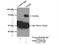 G Protein-Coupled Receptor Kinase 6 antibody, 11439-1-AP, Proteintech Group, Immunoprecipitation image 