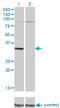 Phosphoribosyl Pyrophosphate Synthetase 2 antibody, LS-C198009, Lifespan Biosciences, Western Blot image 