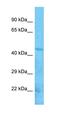 Serine/Threonine Kinase 17b antibody, orb329574, Biorbyt, Western Blot image 