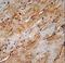 Microtubule Associated Protein 1 Light Chain 3 Beta antibody, LS-C156410, Lifespan Biosciences, Immunohistochemistry frozen image 