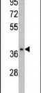 Fructose-Bisphosphatase 2 antibody, PA5-13689, Invitrogen Antibodies, Western Blot image 