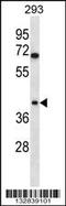 Torsin Family 1 Member B antibody, 56-808, ProSci, Western Blot image 