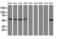 Sequestosome 1 antibody, LS-C785389, Lifespan Biosciences, Western Blot image 