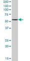 Inosine Monophosphate Dehydrogenase 1 antibody, H00003614-B01P, Novus Biologicals, Western Blot image 