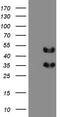 FosB Proto-Oncogene, AP-1 Transcription Factor Subunit antibody, CF804226, Origene, Western Blot image 