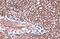 Fatty Acid Binding Protein 4 antibody, GTX116036, GeneTex, Immunohistochemistry paraffin image 