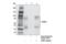Interferon Gamma Receptor 1 antibody, 34808S, Cell Signaling Technology, Immunoprecipitation image 