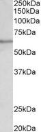 Solute Carrier Family 47 Member 2 antibody, PA5-37990, Invitrogen Antibodies, Western Blot image 