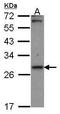 Carbonyl Reductase 1 antibody, GTX100207, GeneTex, Western Blot image 