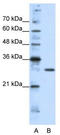 Goosecoid Homeobox 2 antibody, TA343525, Origene, Western Blot image 