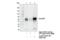 SMAD Family Member 3 antibody, 8685S, Cell Signaling Technology, Immunoprecipitation image 