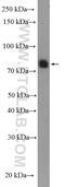 Spermatogenesis Associated 20 antibody, 18373-1-AP, Proteintech Group, Western Blot image 