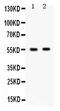 Gamma-Aminobutyric Acid Type A Receptor Beta3 Subunit antibody, PB9595, Boster Biological Technology, Western Blot image 