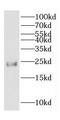 COP9 Signalosome Subunit 8 antibody, FNab01874, FineTest, Western Blot image 