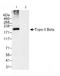 DNA Topoisomerase II Beta antibody, ab72334, Abcam, Immunoprecipitation image 