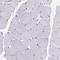 Pappalysin 1 antibody, NBP1-90087, Novus Biologicals, Immunohistochemistry paraffin image 
