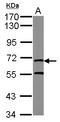 MRE11 Homolog, Double Strand Break Repair Nuclease antibody, LS-C155765, Lifespan Biosciences, Western Blot image 