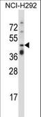TNF Receptor Superfamily Member 10a antibody, LS-C162057, Lifespan Biosciences, Western Blot image 