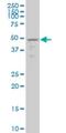 Testis Specific Serine Kinase 1B antibody, H00083942-M02, Novus Biologicals, Western Blot image 