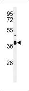 Divergent Protein Kinase Domain 2A antibody, 64-192, ProSci, Western Blot image 