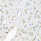 Eukaryotic Translation Initiation Factor 3 Subunit M antibody, 19-365, ProSci, Immunohistochemistry paraffin image 