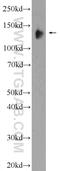 Gse1 Coiled-Coil Protein antibody, 24947-1-AP, Proteintech Group, Western Blot image 