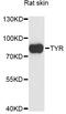 Tyrosinase antibody, LS-C748650, Lifespan Biosciences, Western Blot image 