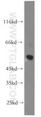 Glycine Receptor Alpha 3 antibody, 13145-1-AP, Proteintech Group, Western Blot image 
