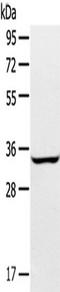 Interleukin 17B antibody, TA351775, Origene, Western Blot image 