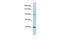 DNA Polymerase Kappa antibody, PA5-43223, Invitrogen Antibodies, Western Blot image 