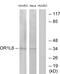 Olfactory Receptor Family 1 Subfamily L Member 6 antibody, GTX87975, GeneTex, Western Blot image 