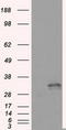 Fumarylacetoacetate Hydrolase Domain Containing 2A antibody, TA500944, Origene, Western Blot image 